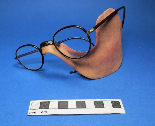 Painted metal facial prosthesis attributed to Anna Coleman Ladd