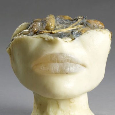 The Bachelor’s Ashtray I (1972), Alina Szapocznikow. © ADAGP, Paris 2017. Courtesy The Estate of Alina Szapocznikow / Piotr Stanislawski / Galerie Loevenbruck, Paris. Photo: Fabrice Gousset