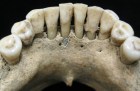A fleck of lapis lazuli found in the lower jaw of a female skeleton from the 11th or 12th century, Photo: Christina Warinner