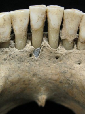 A fleck of lapis lazuli found in the lower jaw of a female skeleton from the 11th or 12th century, Photo: Christina Warinner