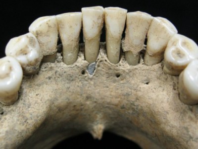 A fleck of lapis lazuli found in the lower jaw of a female skeleton from the 11th or 12th century, Photo: Christina Warinner