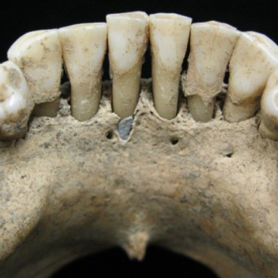 A fleck of lapis lazuli found in the lower jaw of a female skeleton from the 11th or 12th century, Photo: Christina Warinner
