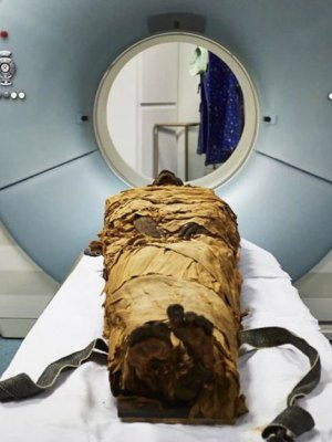 An ancient Egyptian mummy, Nesyamun, laid on the couch to be CT scanned at Leeds General Infirmary.