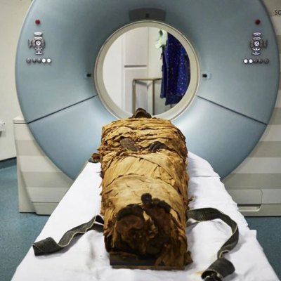 An ancient Egyptian mummy, Nesyamun, laid on the couch to be CT scanned at Leeds General Infirmary.